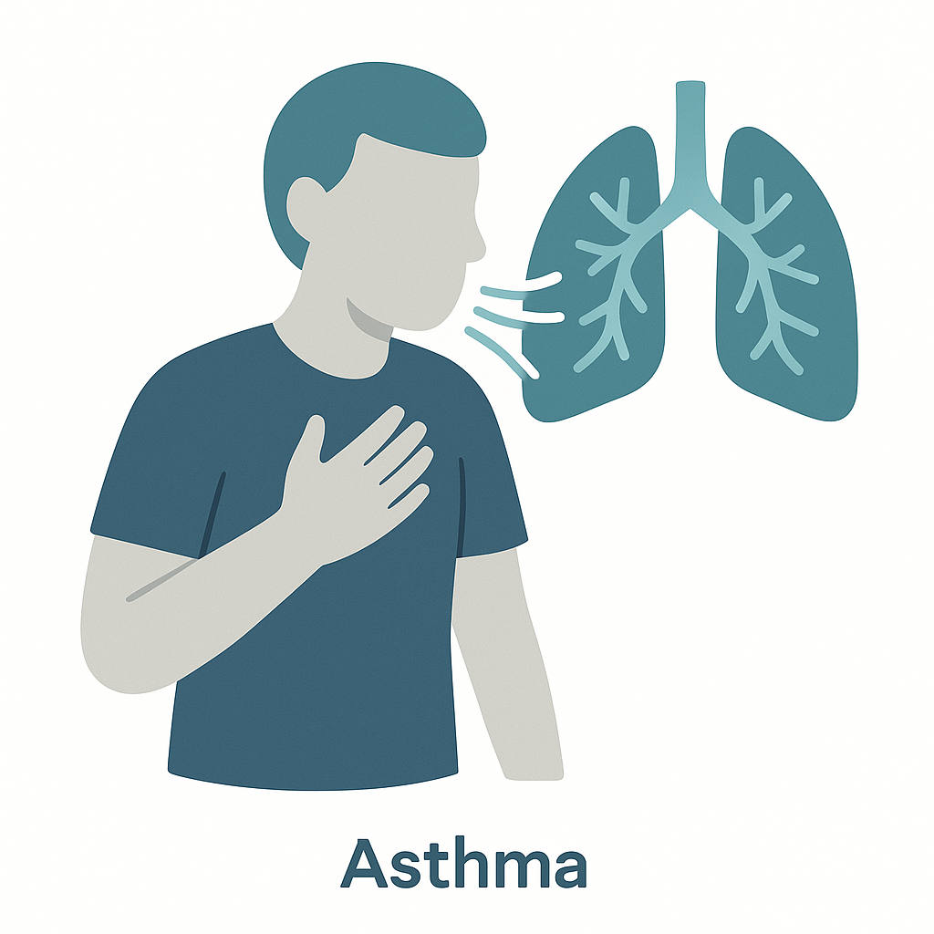 Illustration of Asthma
