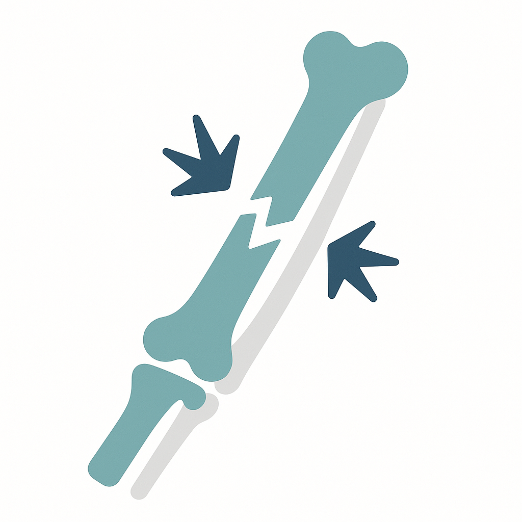 Illustration of Fracture